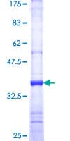 Human PLAA Protein (Recombinant GST, N-terminus)