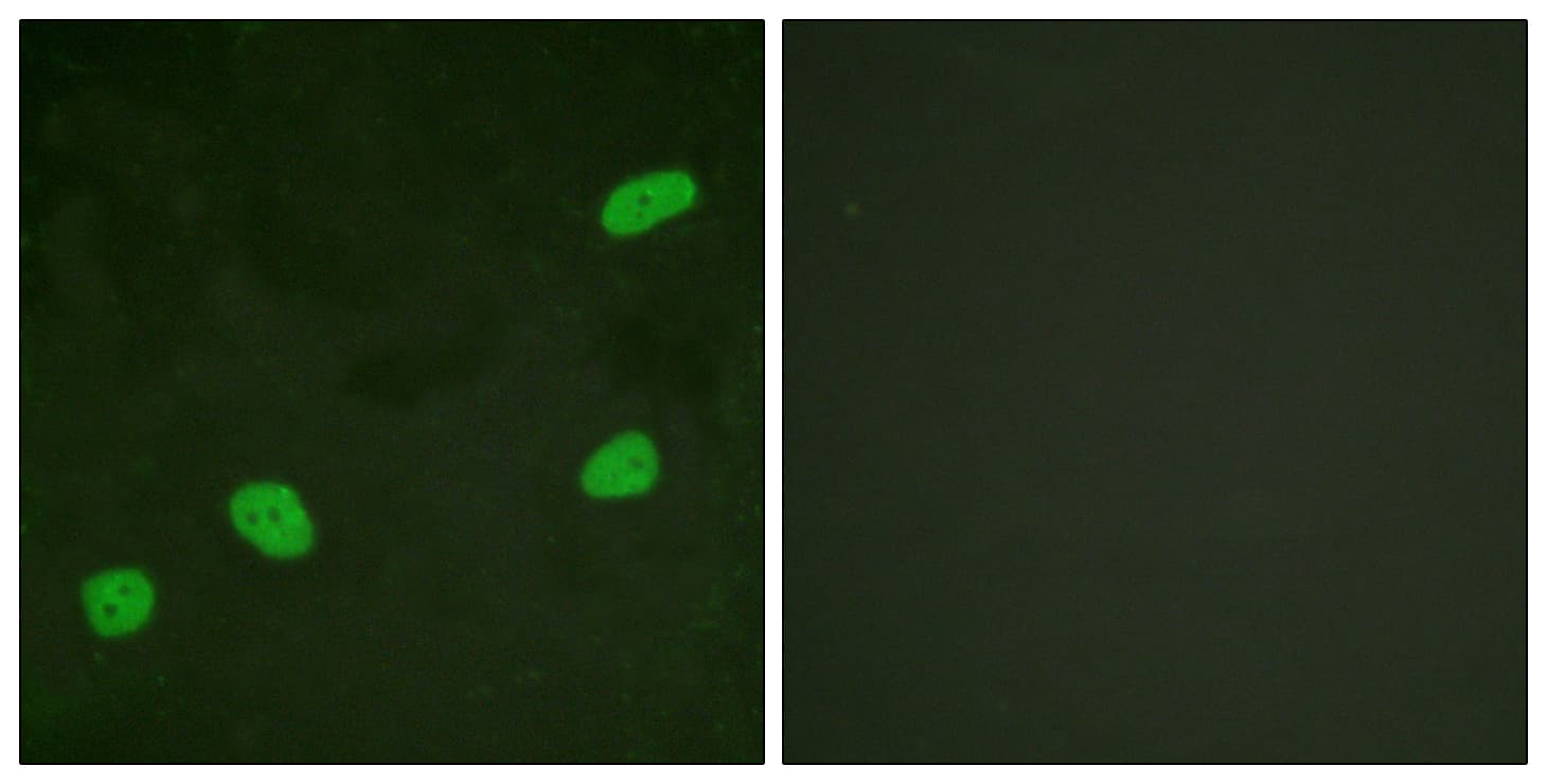 ATRIP Antibody (aa34-83)