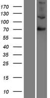F13B / TGase Protein (Over-Expression Lysate Myc-DDK (Flag))