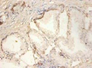 Polyclonal Rabbit anti-Human PLA2G2A / SPLA2 Antibody (IHC, WB)