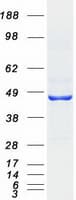 Human HSD2 / HSD11B2 Protein (Recombinant Myc-DDK (Flag))