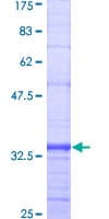 Human CX3CR1 Protein (Recombinant GST, N-terminus)