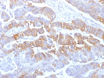 CDH1 / E Cadherin Antibody (clone rCDH1/1525, Azide-free, Carrier-free)