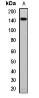 Polyclonal Rabbit anti-Human ABCB1 / MDR1 / P Glycoprotein Antibody (WB)