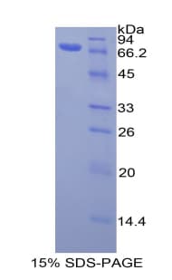 Human ACTG1 / Gamma Actin Protein (Recombinant His-GST)