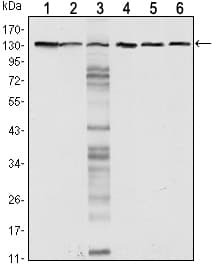 CDH1 / E Cadherin Antibody (clone 7A2)