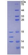 Human IL15 Protein (Recombinant His, N-Terminal)
