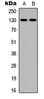 Polyclonal Rabbit anti-Human JMY Antibody (C-Terminus, IHC, WB)