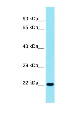Polyclonal Rabbit anti-Human SPRYD4 Antibody (N-Terminus, WB)