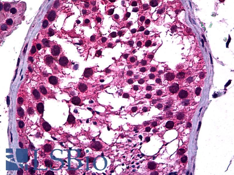 IHC-plus™ NEUROD1 Antibody (clone 3D11)