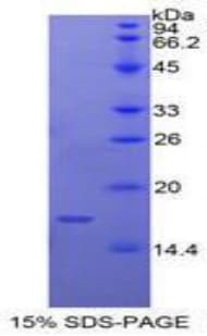Human CASP9 / Caspase 9 Protein (Recombinant His)