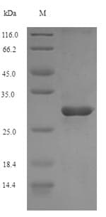 Mouse CR2 / CD21 Protein (Recombinant 6His, N-terminus)