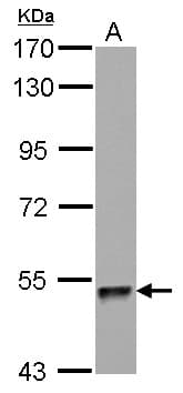 ZNF689 Antibody