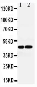 AVPR1A / V1a Receptor Antibody (aa155-173)