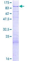 Human DLAT / PDC-E2 Protein (Recombinant GST)