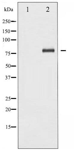 RELA / NFKB p65 Antibody (phospho-Ser276)