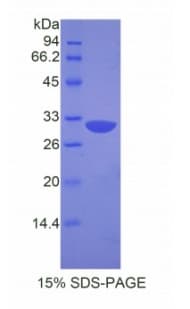 Mouse APAF1 / APAF-1 Protein (Recombinant His)