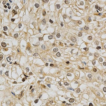 Polyclonal Rabbit anti-Human GSTT1 Antibody (IHC, WB)