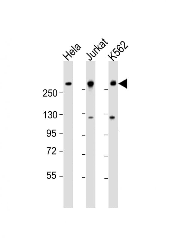 Polyclonal Rabbit anti-Human CHD3 Antibody (aa595-629, WB)