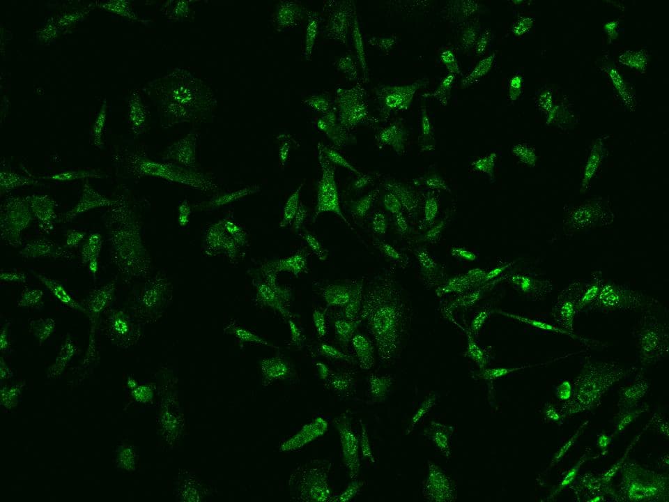 PGAM1 Antibody