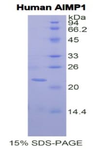 Human AIMP1 / EMAP II Protein (Recombinant His)
