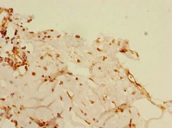 BLID Antibody