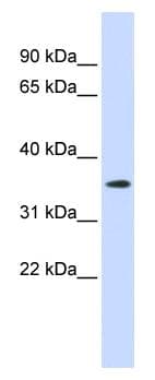 GPR6 Antibody (N-Terminus, FITC)
