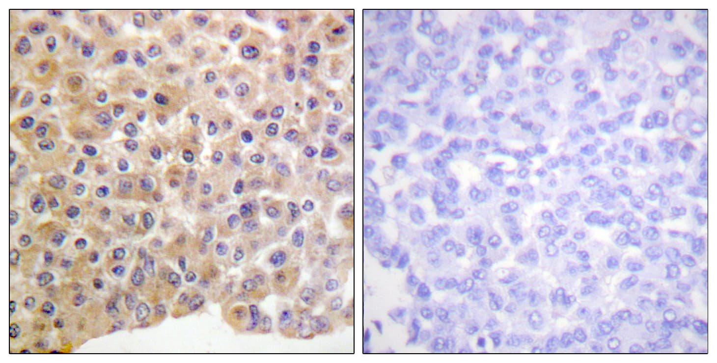 INSR / Insulin Receptor Antibody (phospho-Tyr1361)