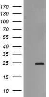 RAB21 Antibody (clone OTI6A9)