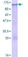 Human STAT5A Protein (Recombinant GST)