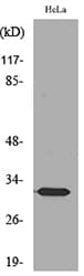 SDHB Antibody