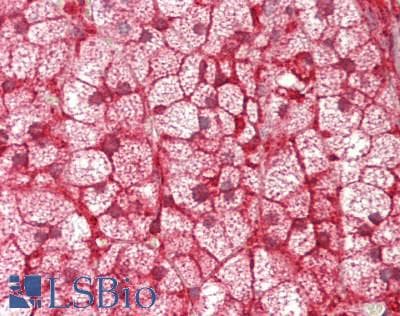 IHC-plus™ Polyclonal Rabbit anti-Human CYP21A2 Antibody (aa216-246, IHC, IF, WB)