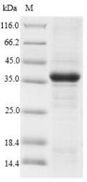 Rat CD300LF / CD300f Protein (Recombinant 10His-SUMO, N-terminus + Myc, C-terminus)