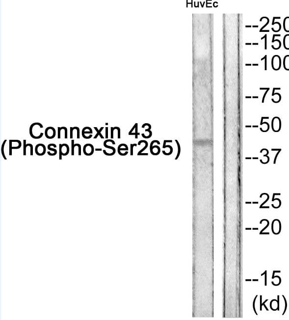 GJA1 / CX43 / Connexin 43 Antibody (phospho-Ser265)