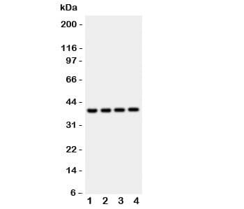 CTSD / Cathepsin D Antibody (aa65-410)
