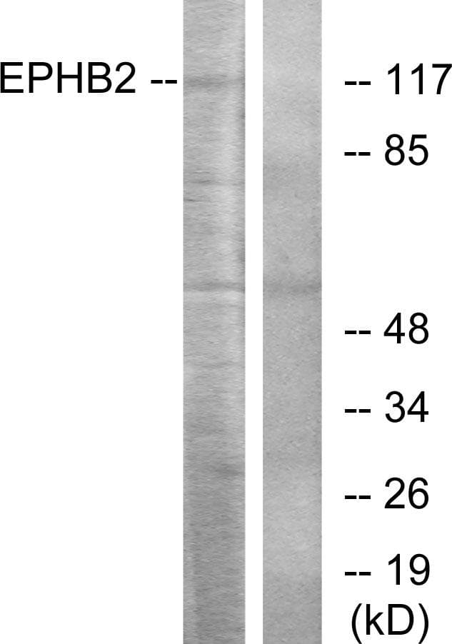 Polyclonal Rabbit anti-Human EPHB2 / EPH Receptor B2 Antibody (WB)