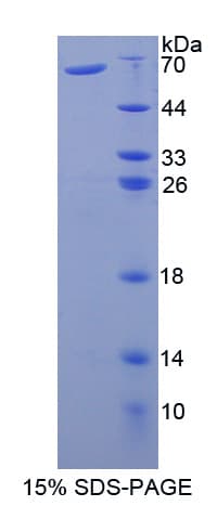 Human Prothrombin Fragment 1+2 Protein (Recombinant His-GST-S)
