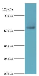 Polyclonal Rabbit anti-Human PARP3 Antibody (aa294-533, IHC, WB)