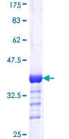 Human DDB1 Protein (Recombinant GST, N-terminus)