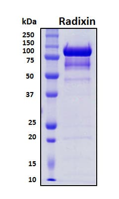 Human RDX / Radixin Protein (Recombinant His, N-Terminal)
