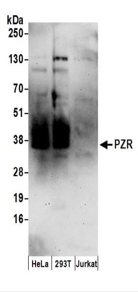 MPZL1 Antibody (aa225-275)