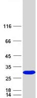 Human SSSCA1 / p27 Protein (Recombinant Myc-DDK (Flag))