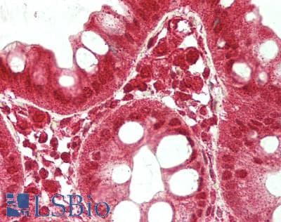 IHC-plus™ PBRM1 / BAF180 / PB1 Antibody (aa1639-1689)