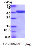 Mouse ANXA1 / Annexin A1 Protein (Recombinant His)