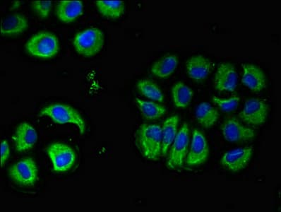 CHRM5 / M5 Antibody
