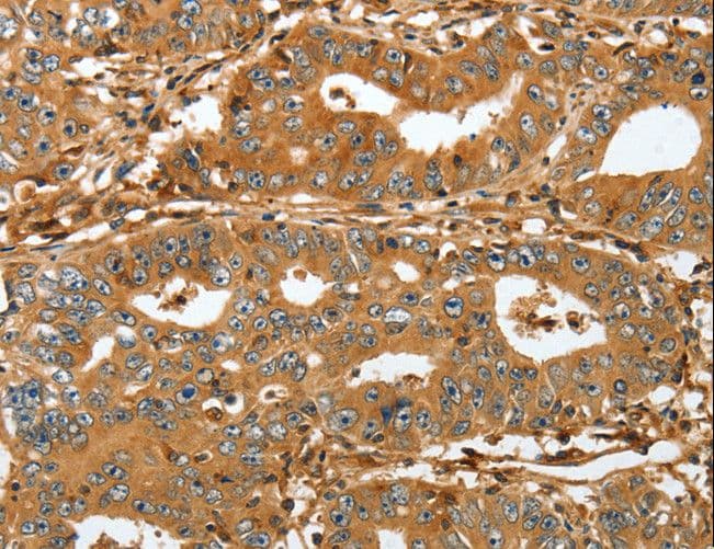 Polyclonal Rabbit anti-Human RAP1A Antibody (IHC)