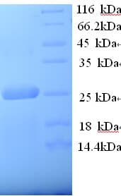 Human LRP2 / Megalin Protein (Recombinant 6His, N-terminus)