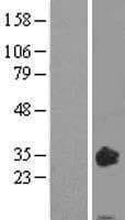 OSM / Oncostatin M Protein (Over-Expression Lysate Myc-DDK (Flag))