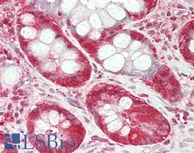 IHC-plus™ USP6NL Antibody (aa350-400)