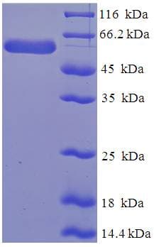 Human SERPINB1 Protein (Recombinant His-SUMO)